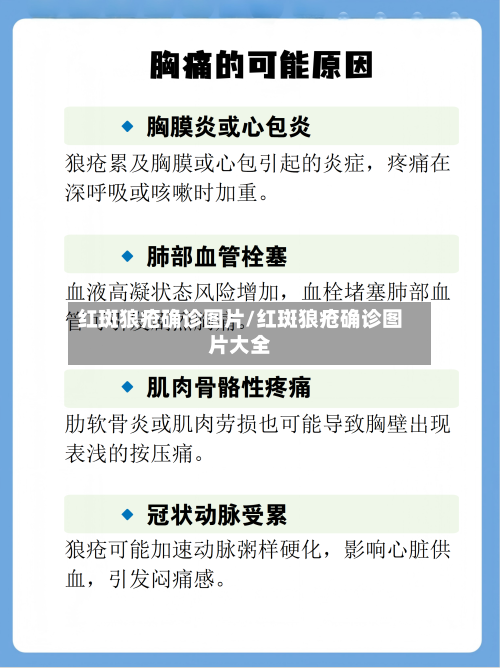 红斑狼疮确诊图片/红斑狼疮确诊图片大全-第2张图片