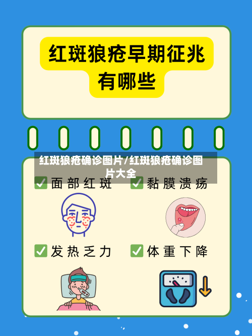 红斑狼疮确诊图片/红斑狼疮确诊图片大全