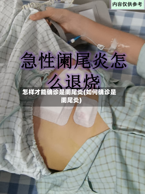 怎样才能确诊是阑尾炎(如何确诊是阑尾炎)-第1张图片