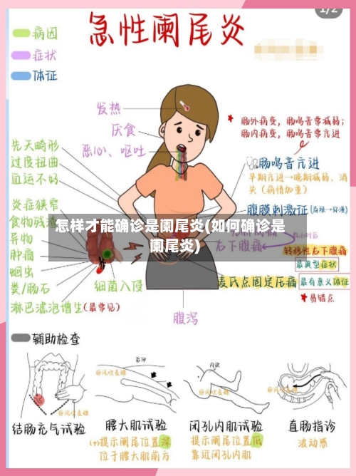 怎样才能确诊是阑尾炎(如何确诊是阑尾炎)-第3张图片