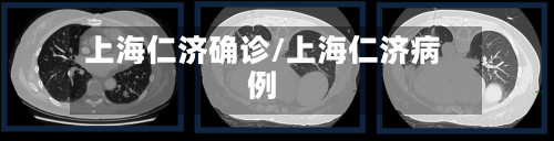 上海仁济确诊/上海仁济病例-第2张图片