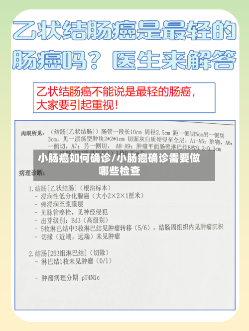 小肠癌如何确诊/小肠癌确诊需要做哪些检查-第2张图片