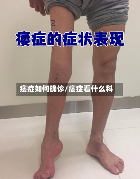 痿症如何确诊/痿症看什么科