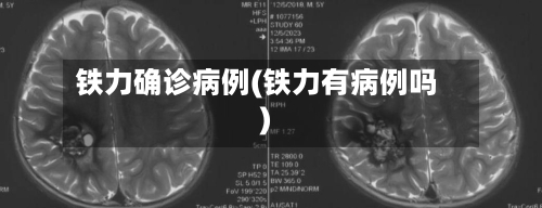 铁力确诊病例(铁力有病例吗)-第3张图片