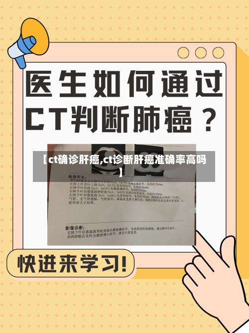 【ct确诊肝癌,ct诊断肝癌准确率高吗】