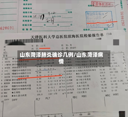 山东菏泽肺炎确诊几例/山东菏泽病情-第2张图片