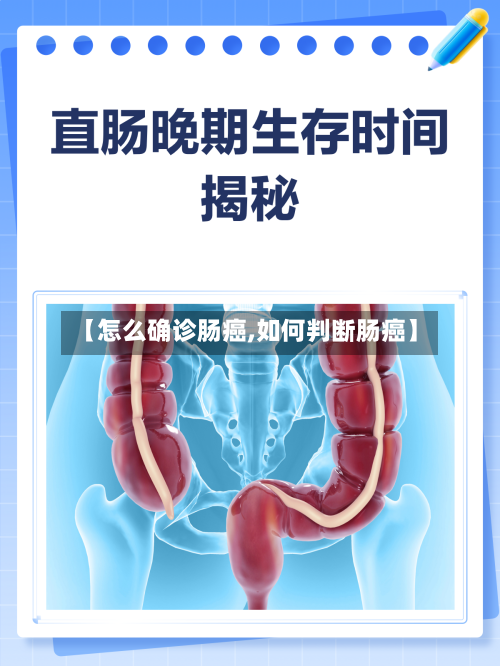 【怎么确诊肠癌,如何判断肠癌】