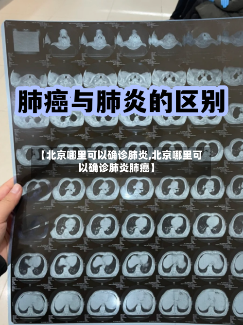 【北京哪里可以确诊肺炎,北京哪里可以确诊肺炎肺癌】