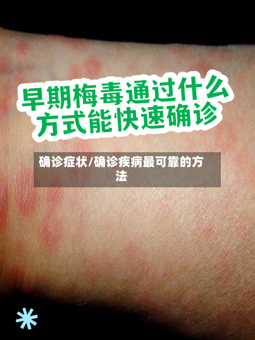 确诊症状/确诊疾病最可靠的方法-第2张图片