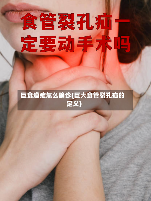 巨食道症怎么确诊(巨大食管裂孔疝的定义)