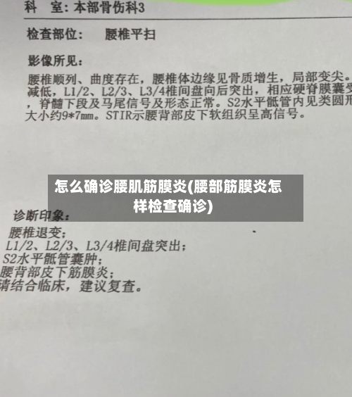 怎么确诊腰肌筋膜炎(腰部筋膜炎怎样检查确诊)-第3张图片