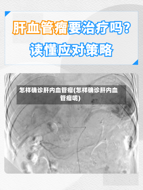 怎样确诊肝内血管瘤(怎样确诊肝内血管瘤呢)-第2张图片