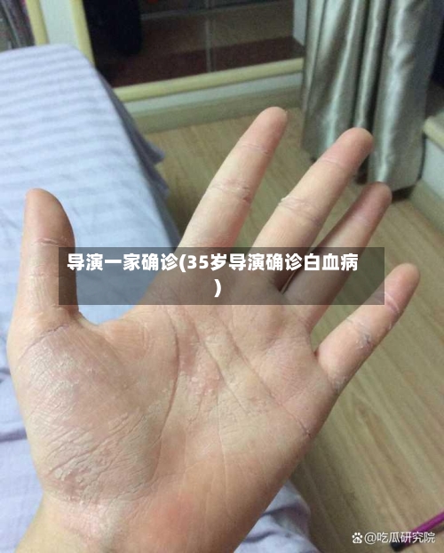 导演一家确诊(35岁导演确诊白血病)-第3张图片