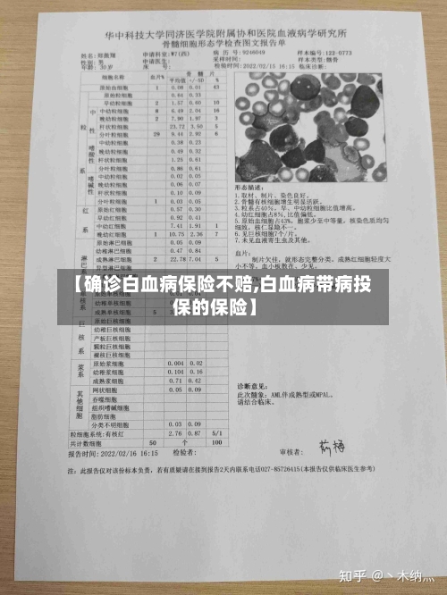 【确诊白血病保险不赔,白血病带病投保的保险】-第2张图片