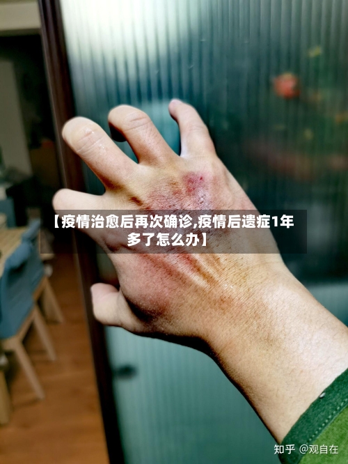 【疫情治愈后再次确诊,疫情后遗症1年多了怎么办】