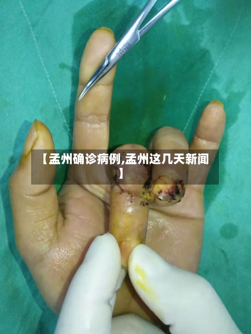 【孟州确诊病例,孟州这几天新闻】-第3张图片