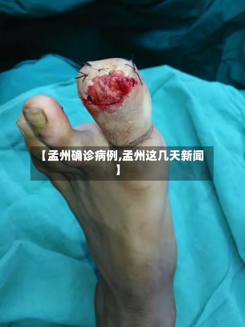 【孟州确诊病例,孟州这几天新闻】-第2张图片