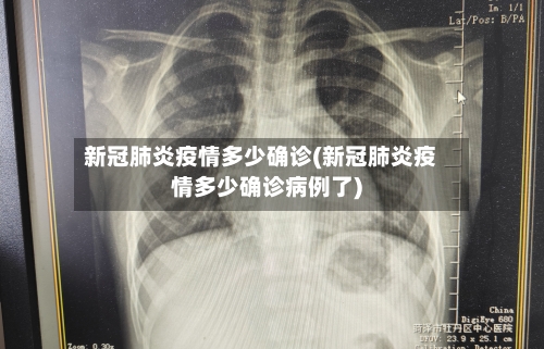 新冠肺炎疫情多少确诊(新冠肺炎疫情多少确诊病例了)-第2张图片