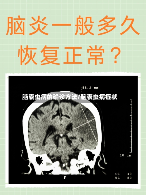 脑囊虫病的确诊方法/脑囊虫病症状-第2张图片