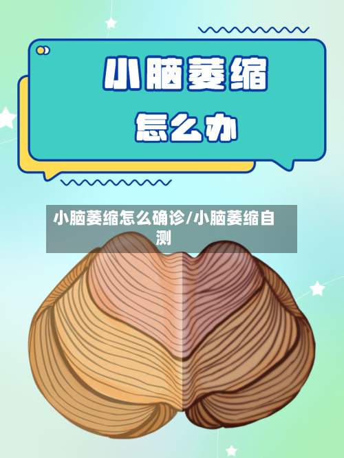小脑萎缩怎么确诊/小脑萎缩自测-第3张图片